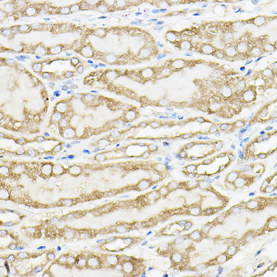 PKM1-specific Rabbit pAb