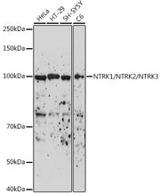 NTRK1/NTRK2/NTRK3 Rabbit pAb