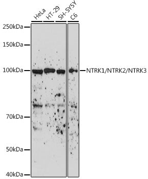 NTRK1/NTRK2/NTRK3 Rabbit pAb