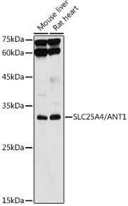 [KO Validated] SLC25A4/ANT1 Rabbit pAb
