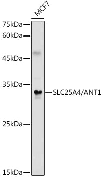 [KO Validated] SLC25A4/ANT1 Rabbit pAb