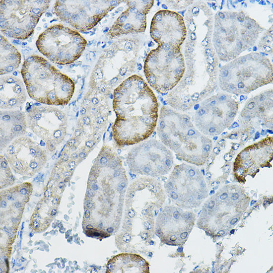 FAM160B2 Rabbit pAb