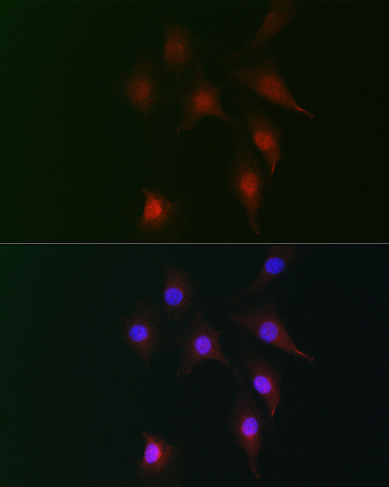 FAM160B2 Rabbit pAb