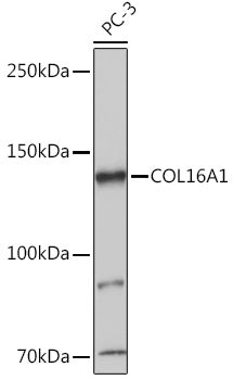 COL16A1 Rabbit pAb