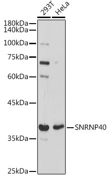 SNRNP40 Rabbit pAb