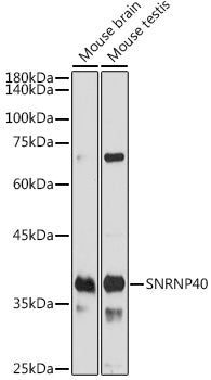 SNRNP40 Rabbit pAb