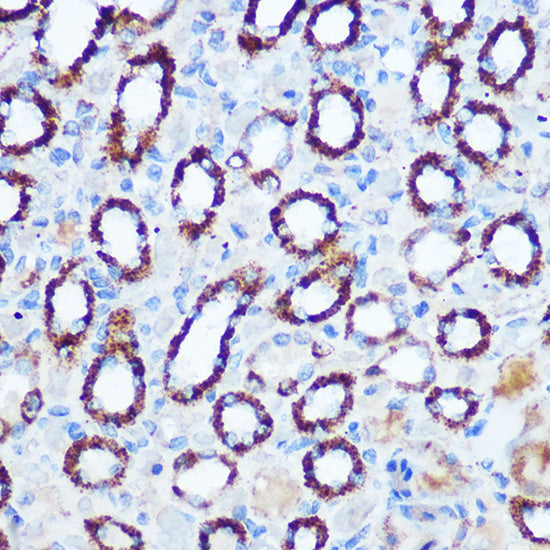 PDHA1 Rabbit pAb