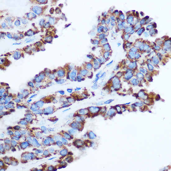 PDHA1 Rabbit pAb