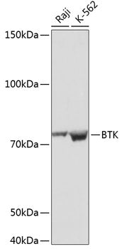BTK Rabbit mAb