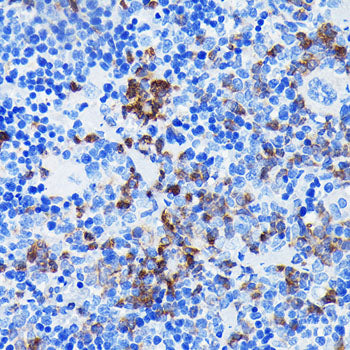 BTK Rabbit mAb