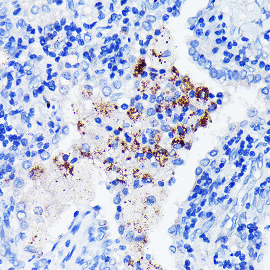 BTK Rabbit mAb