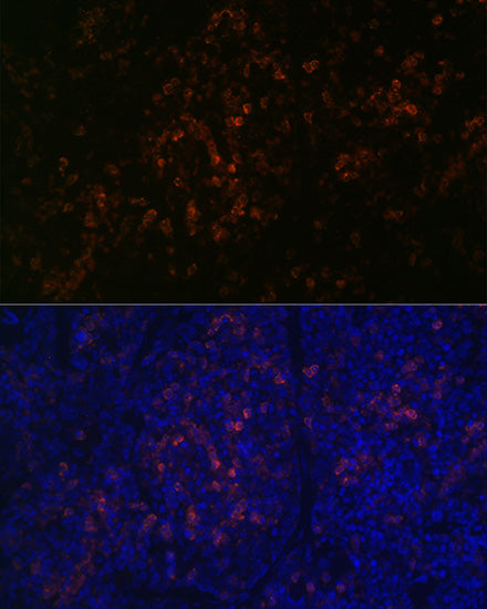 BTK Rabbit mAb
