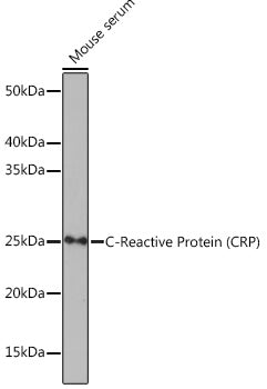 C-Reactive Protein (CRP) Rabbit mAb