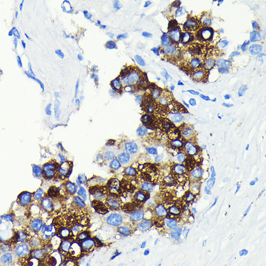 C-Reactive Protein (CRP) Rabbit mAb