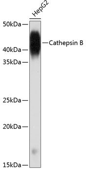 Cathepsin B Rabbit mAb