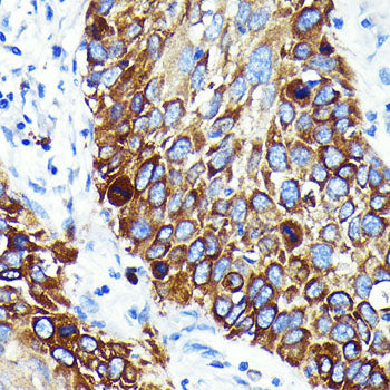 Cathepsin B Rabbit mAb