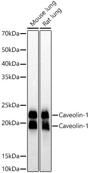 [KO Validated] Caveolin-1 Rabbit mAb