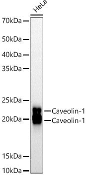 [KO Validated] Caveolin-1 Rabbit mAb