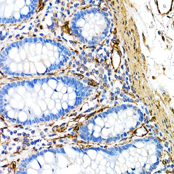 [KO Validated] Caveolin-1 Rabbit mAb