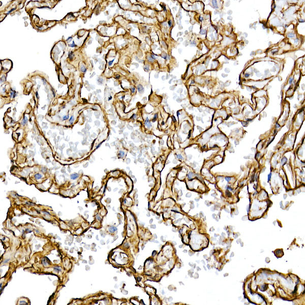 [KO Validated] Caveolin-1 Rabbit mAb