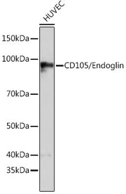CD105/Endoglin Rabbit mAb