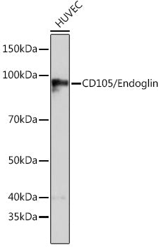 CD105/Endoglin Rabbit mAb