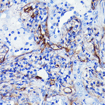 CD105/Endoglin Rabbit mAb