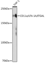 CD11a/LFA-1A/ITGAL Rabbit mAb