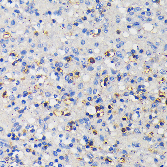 CD11a/LFA-1A/ITGAL Rabbit mAb