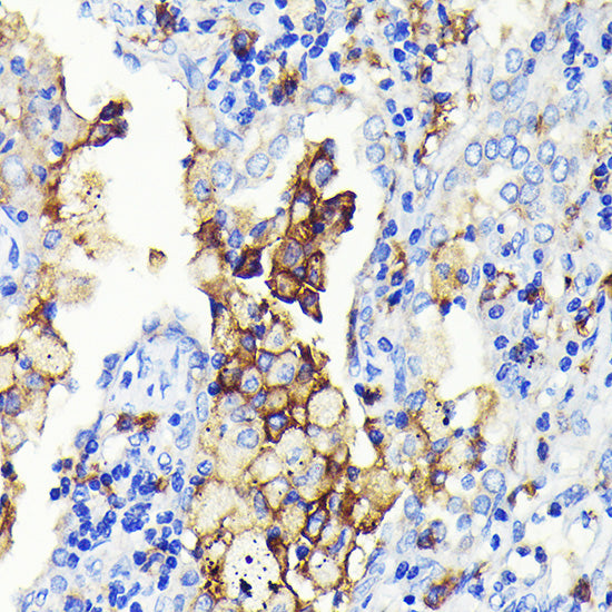 CD14 Rabbit mAb