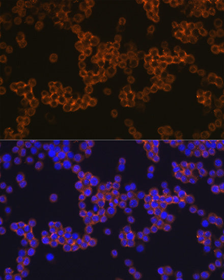 CD14 Rabbit mAb