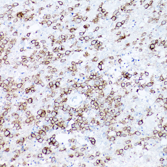 CD19 Rabbit mAb