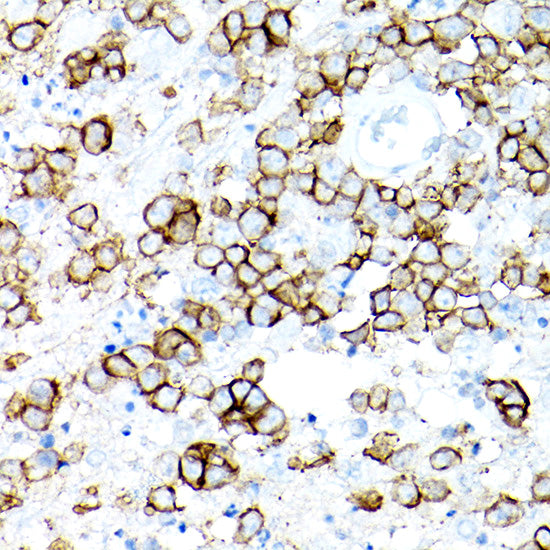 CD19 Rabbit mAb