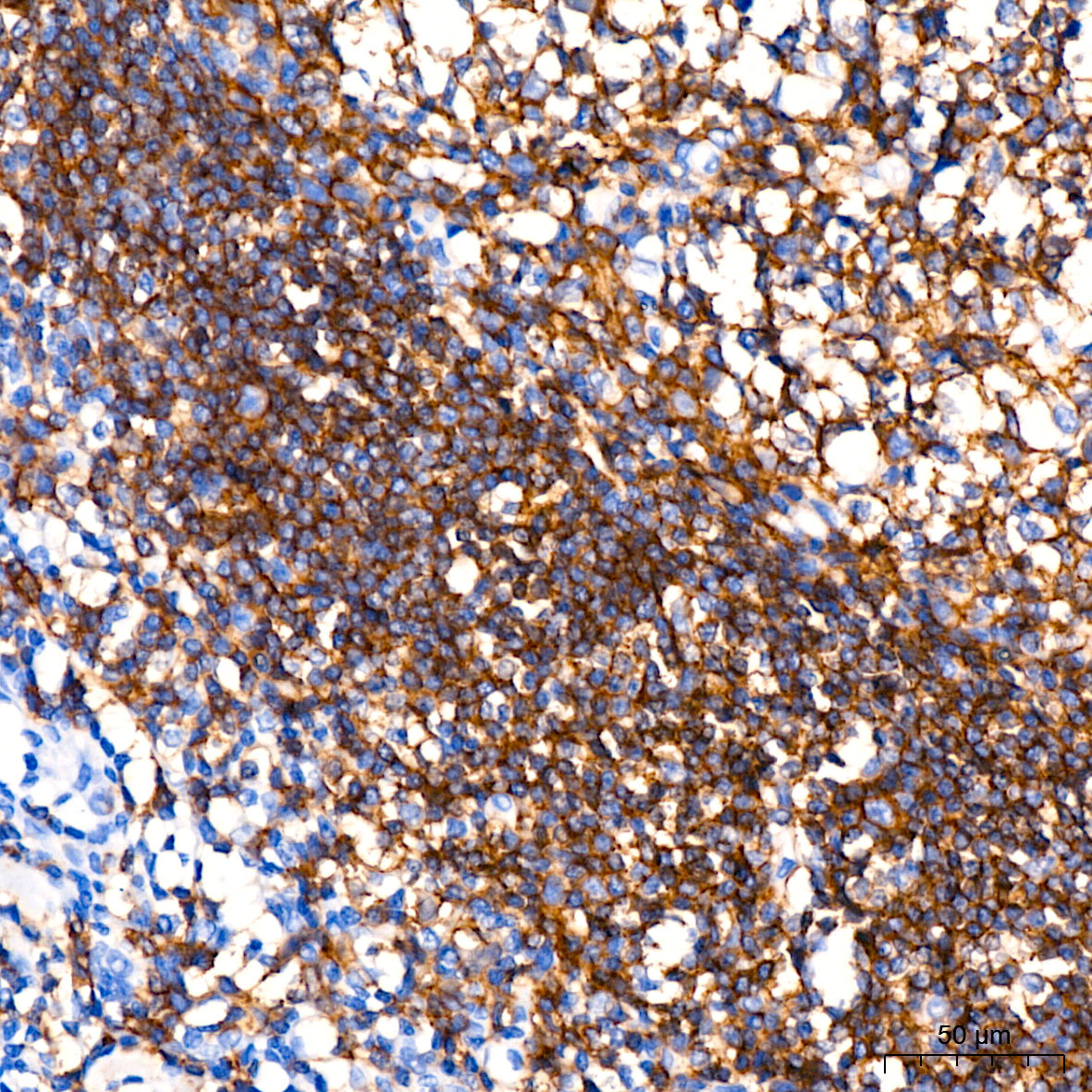 CD19 Rabbit mAb