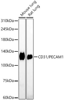 CD31/PECAM1 Rabbit mAb