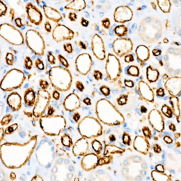 CD31/PECAM1 Rabbit mAb