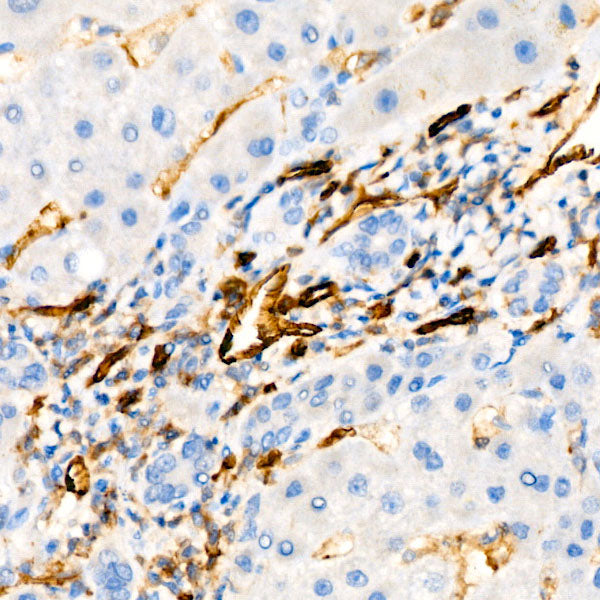 CD31/PECAM1 Rabbit mAb