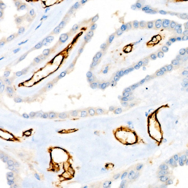 CD31/PECAM1 Rabbit mAb