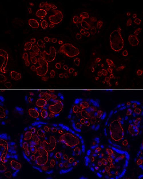 CD31/PECAM1 Rabbit mAb