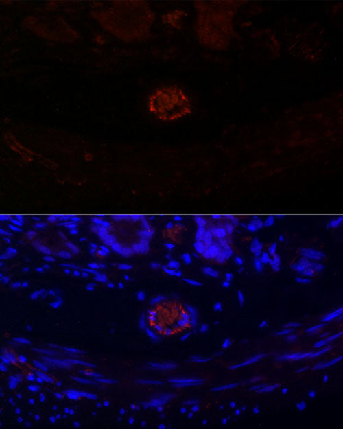 CD31/PECAM1 Rabbit mAb