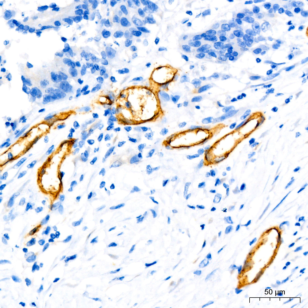 CD34 Rabbit mAb