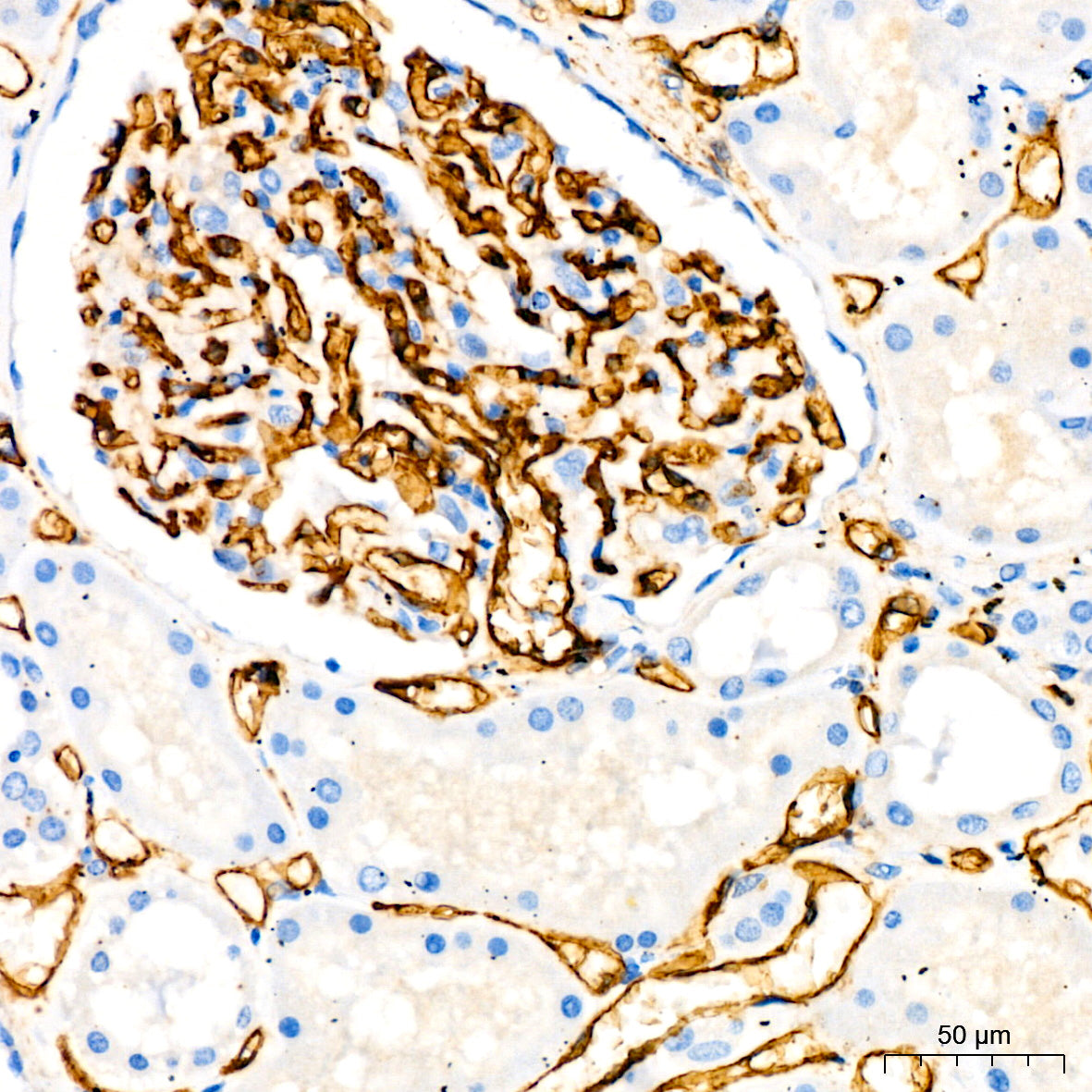 CD34 Rabbit mAb