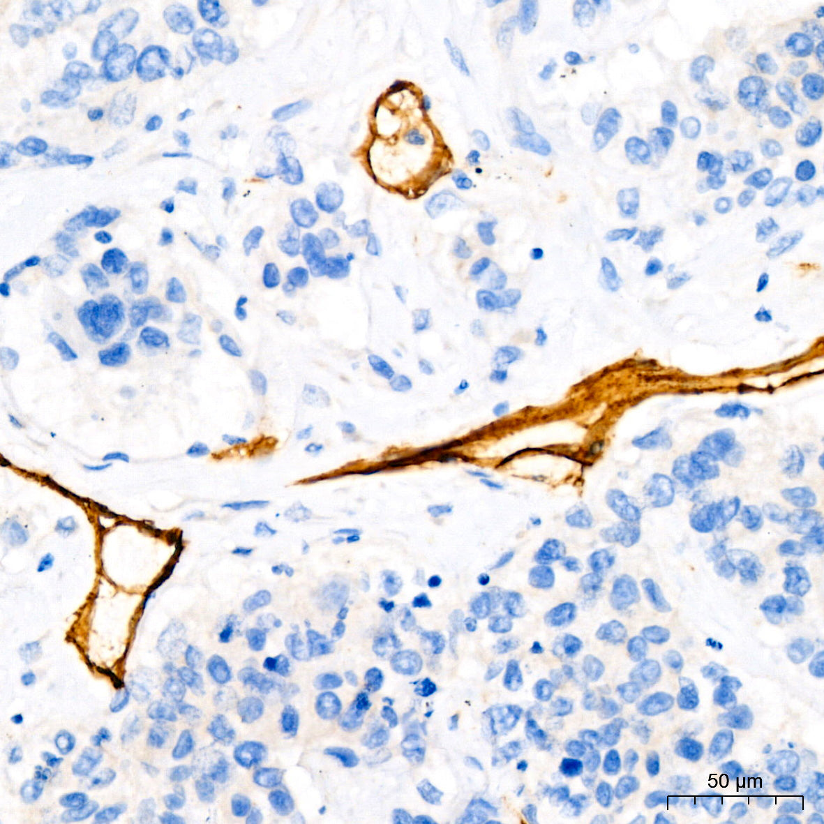 CD34 Rabbit mAb