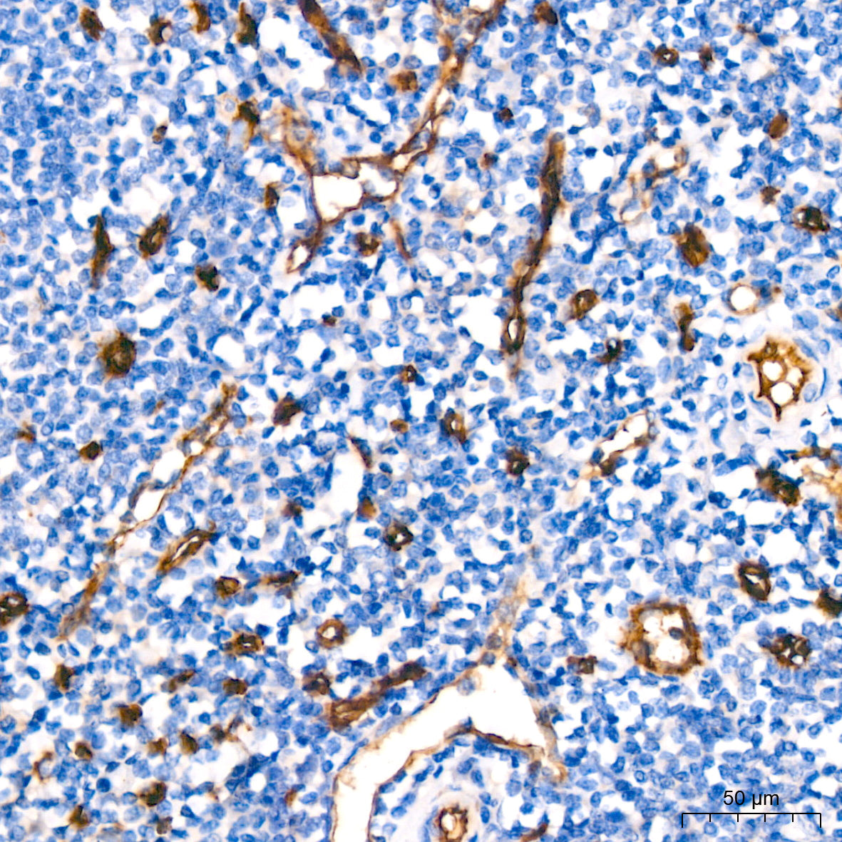 CD34 Rabbit mAb