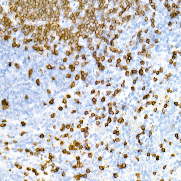 CD3E Rabbit mAb