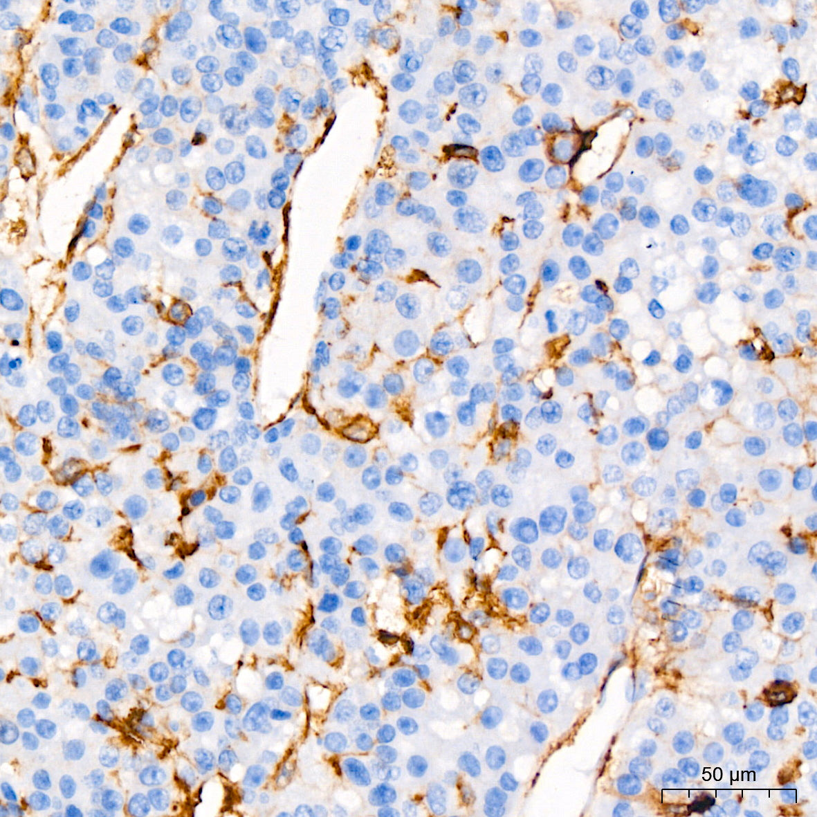 [KO Validated] CD44 Rabbit mAb