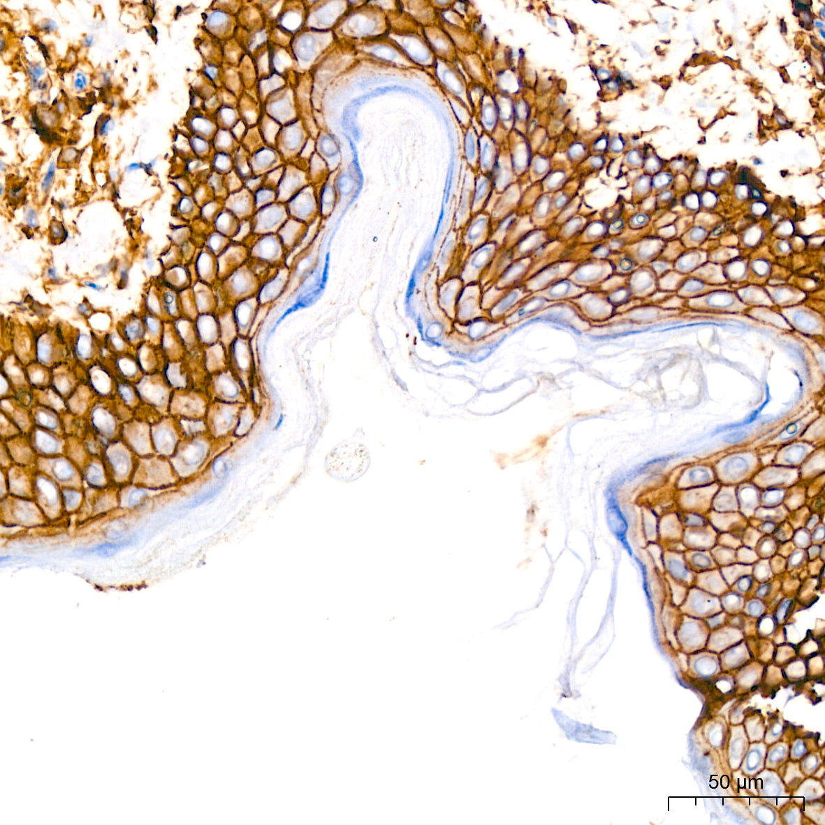 [KO Validated] CD44 Rabbit mAb