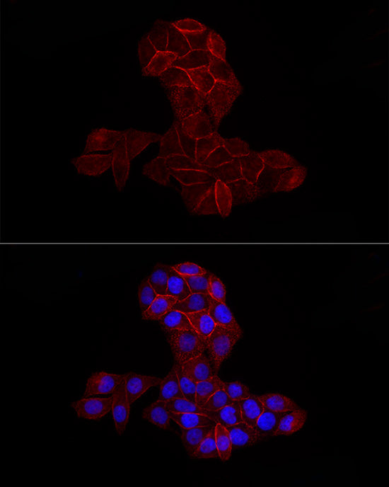 [KO Validated] CD44 Rabbit mAb