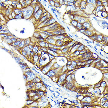 CD46 Rabbit mAb