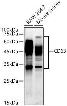 CD63 Rabbit mAb